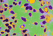 Coloured TEM of activated platelets (thrombocytes)