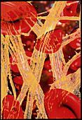 Computer artwork of red blood cells and fibrin
