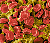 Coloured SEM of a blood clot