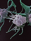 Activated platelets,SEM