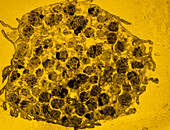 False-colour TEM of a human mast cell