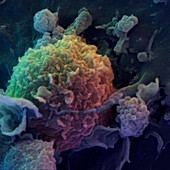 Colour SEM of immune cells: dendritic and T-cells