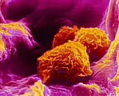 False-colour SEM of three macrophages in lung