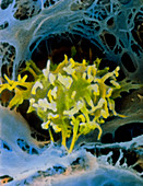 False-colour SEM of macrophage in liver
