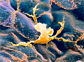 Coloured SEM of an activated macrophage