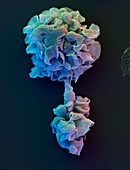 Coloured SEM of phagocytic macrophages