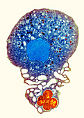 Neutrophil and trapped bacteria,TEM