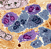 Neutrophil white blood cells,TEM