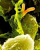 Neutrophils and Shigella bacteria,SEM