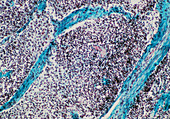 Light micrograph of a normal human lymph node