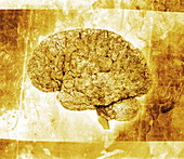 Aged brain