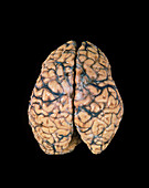 Top view of a healthy human brain