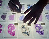 Gloved hands and human brain sections on light box
