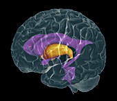Brain ventricles,coloured CT/MRI scan