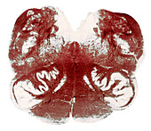 Brainstem cross-section,light micrograph