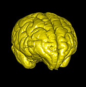 Monkey brain,3D MRI scan
