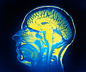 Nuclear magnetic resonance image of the human head