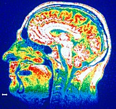 False-colour NMR scan of the head,sagittal slice