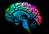 Coloured 3-D MRI sagittal brain scan