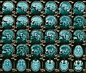 MRI scans of the human brain multiple vie