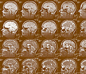 Coloured sagittal MRI scans of the human brain