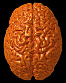 Child's brain,3-D MRI scan