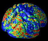 Human brain variation