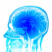 Brain anatomy,MRI scan