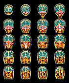 Healthy brain,MRI scans
