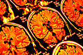 Brain scans,MRI scans
