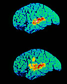 Brain scan when listening repeat words