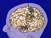Functional map of the brain's motor cortex areas