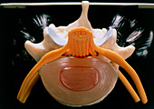 Model of an intervertebral disc from a human spine