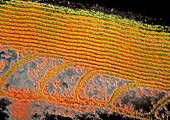 TEM of the myelin sheath around the auditory nerve