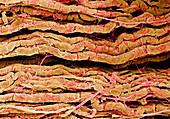 Coloured SEM of nerve fibres