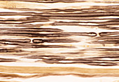 Myelinated nerves,light micrograph