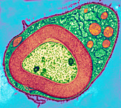 Myelinated nerve,TEM