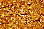 Human cortical pyramidal cells,Bodian stain