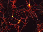Immunofluorescent LM of mammalian brain astrocytes