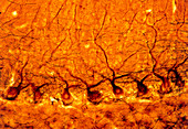 LM of purkinje nerves cells in the cerebe