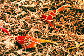 Coloured SEM of spinal cord nerve cells
