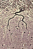 Purkinje nerve cell