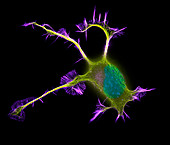 Nerve cell growth