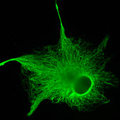 Astrocyte nerve cell