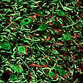 Thalamus nerve cells