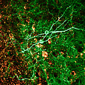 Hippocampus tissue,light micrograph
