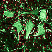 Neurons,confocal light micrograph