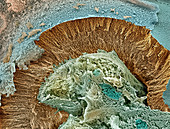 Foetal brain tissue ,SEM