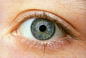 Woman's right eye,with pupil slightly contracted