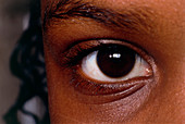 Eye of a young girl